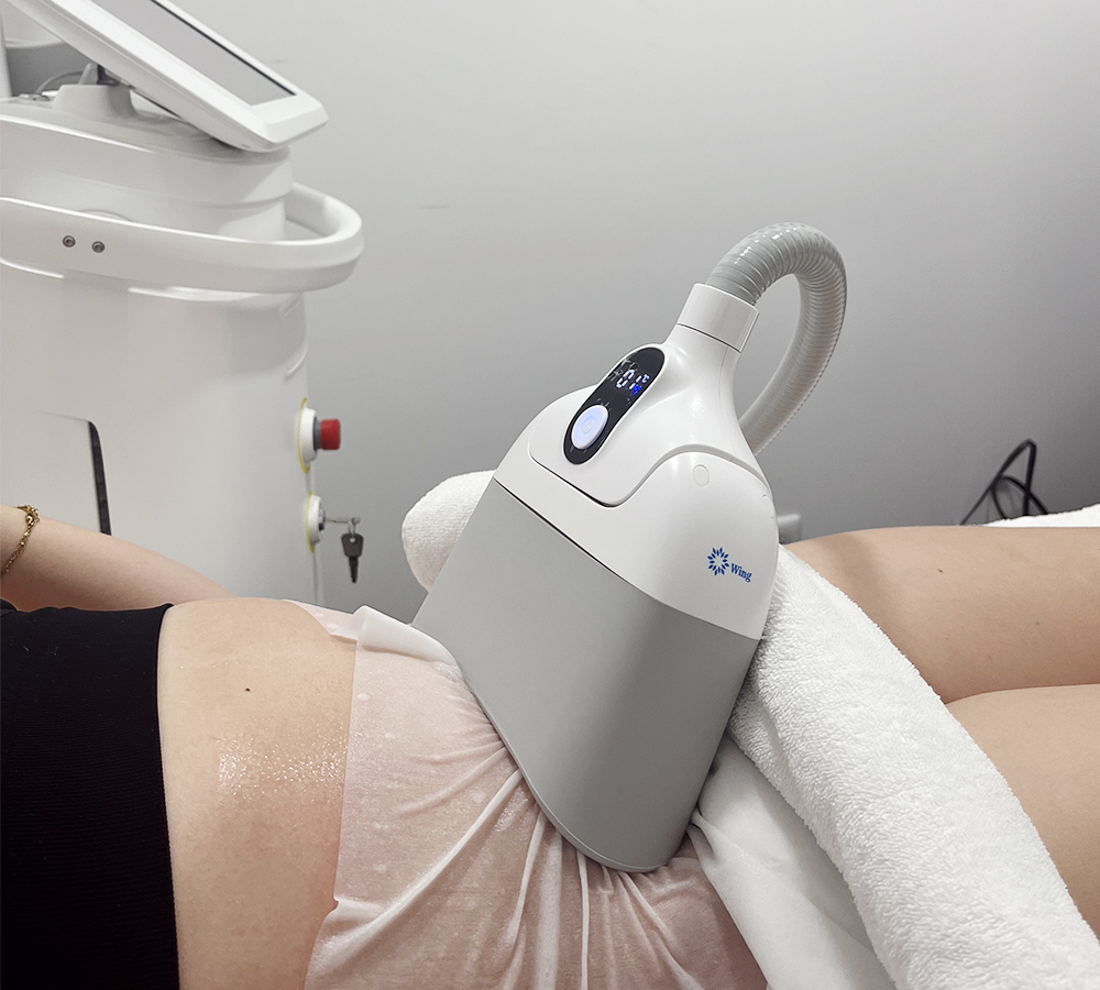 Cryolipolise