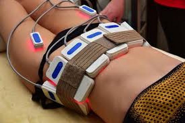 lipolaser